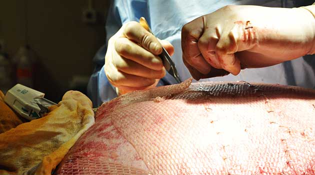 Human skin in use as a skin graft at Queen Astrid Military Hospital in Brussels